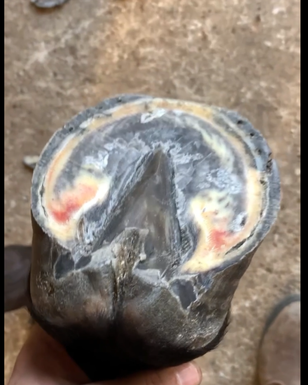 To Fix a Heel Problem, You Have to Understand What Caused It